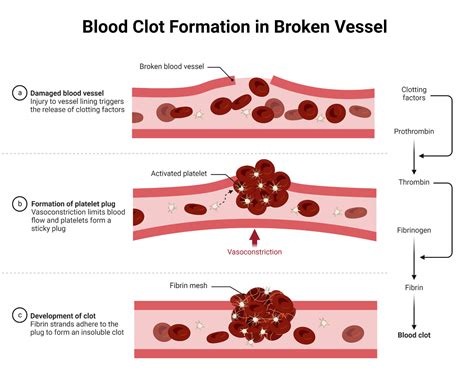 clot siti